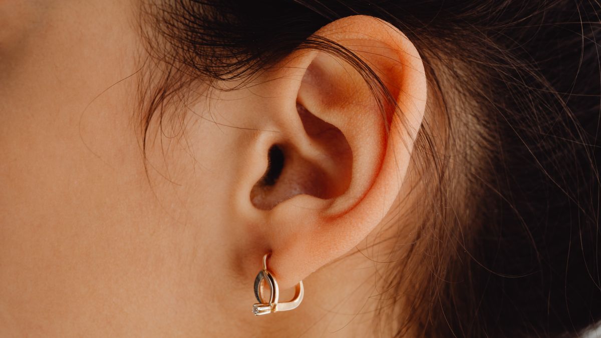 Dihexa for Tinnitus & Hyperacusis
